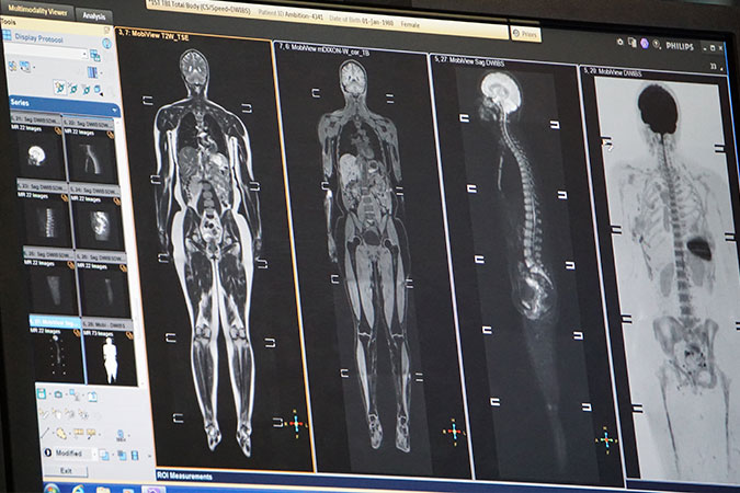 Radiological Image Interpretation