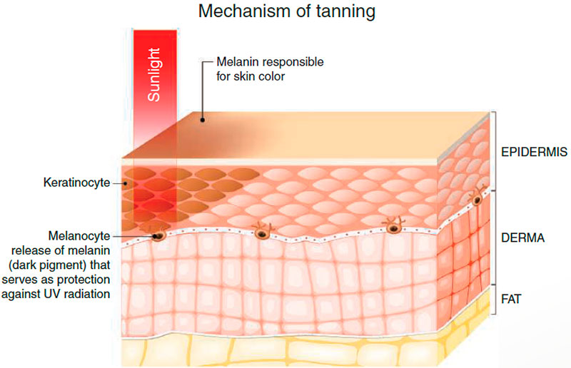 Melanocytes in the epidermis producing melanin