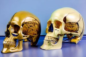 Understanding the Cranial Bones