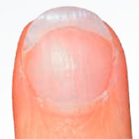 Eggshell nail