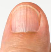 Ridged nail