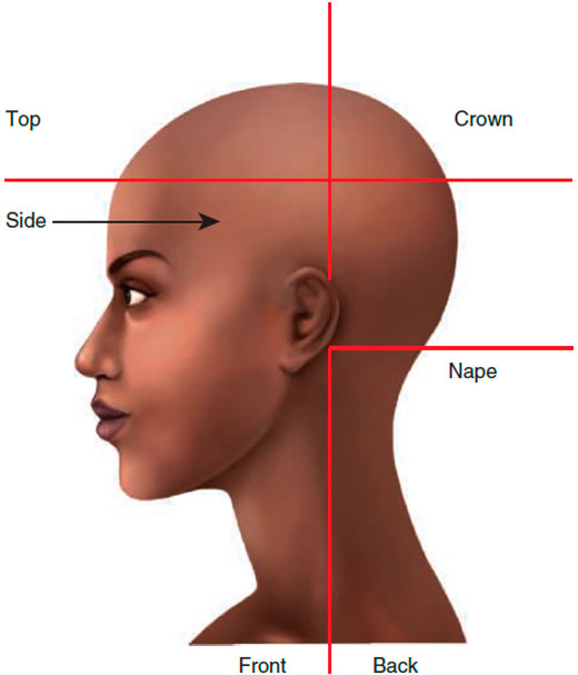 Areas of the head