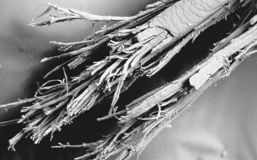 Trichoptilosis (split ends)