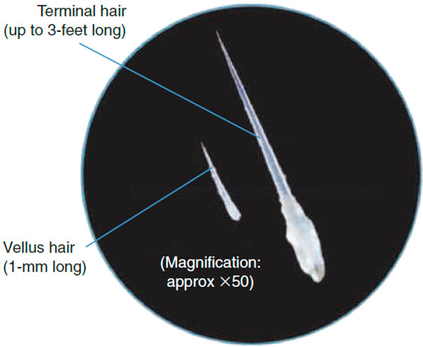 Vellus hair and terminal hair