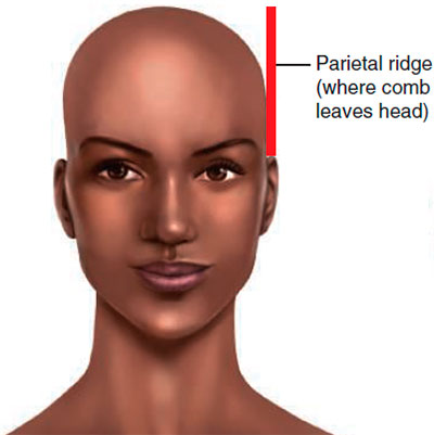 Parietal ridge