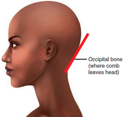 Occipital bone