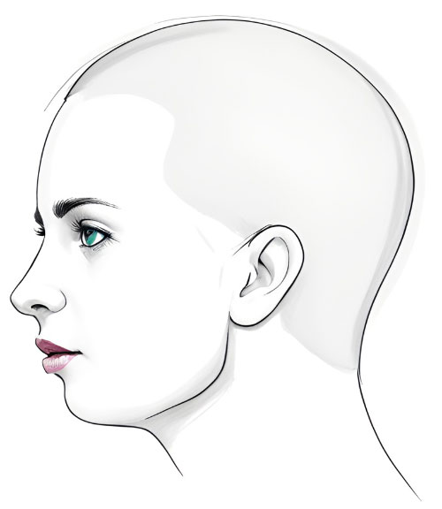 Convex profile